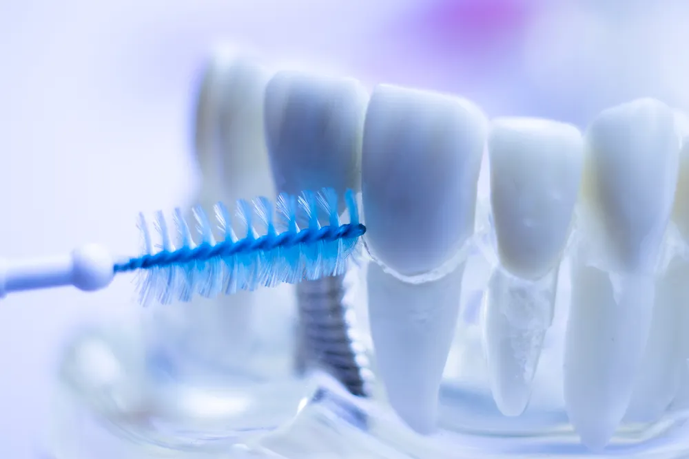 သွားများအတွက် Interdental Brush များ၏ အကျိုးကျေးဇူးများ