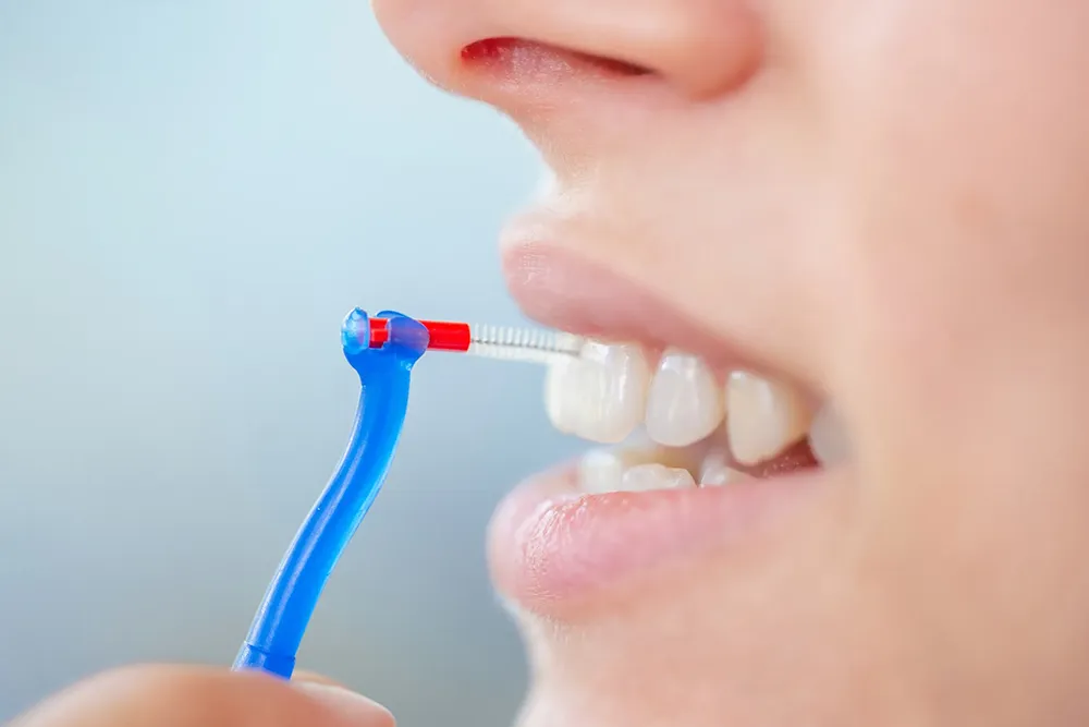 Interdental Brush အသုံးပြုရန် မှန်ကန်သောနည်းလမ်း